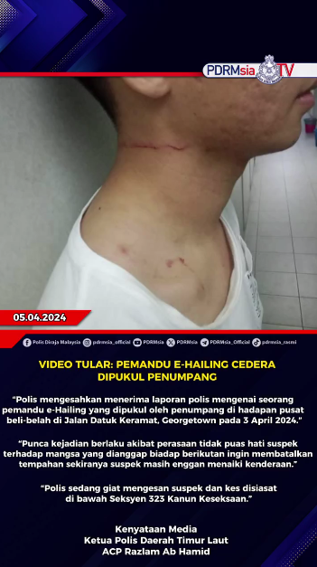 Video Tular Pemandu E Hailing Cedera Dipukul Penumpang