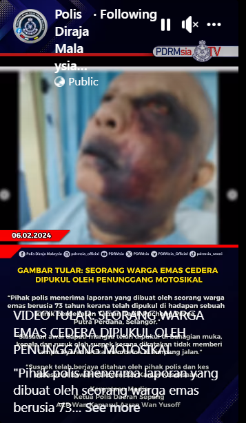 Video Tular Seorang Warga Emas Cedera Dipukul Oleh Penunggang Motosikal